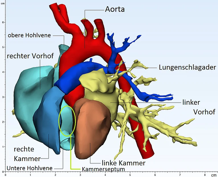 Abb. 2.1.1 Die Anatomie des Herzens. Im Modell wird das Innenleben des Herzens dargestellt, deshalb zeigt sich das Ventrikelseptum hier als Freiraum zwischen den Kammern. Das Atriumseptum ist hier nicht sichtbar.
